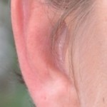 molinary ear